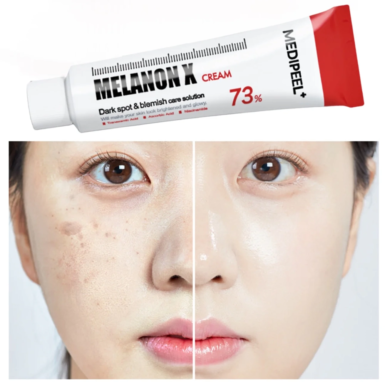 Το σωληνάριο Medipeel Whitening Melanon X Cream 30ml, πάνω από 2 φωτογραφίες που δείχνουν την ίδια ασιάτισα πριν και μετά την χρήση της κρέμας.