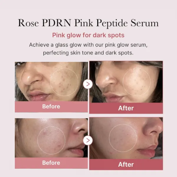 Medicube PDRN Pink Peptide Serum 30ml - Image 10
