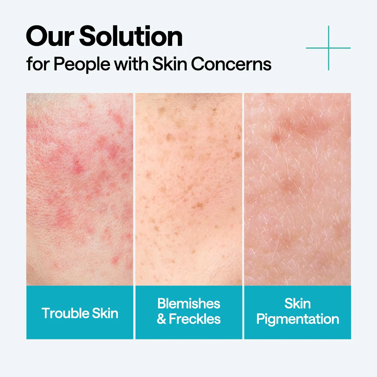 Mediheal Madecassoside Blemish Repair Serum 40ml - Image 7