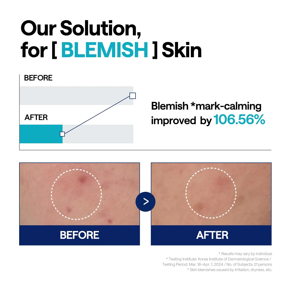 Mediheal Madecassoside Blemish Repair Serum 40ml - Image 6