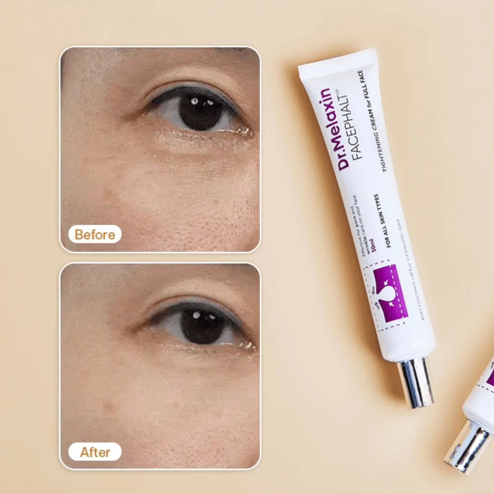 Δύο σωληνάρια Dr. Melaxin Facephalt Tightening Cream, δίπλα από δύο φωτογραφίες, που δείχνουν από ένα μάτι, πριν και μετά την εφαρμογή της κρέμας.