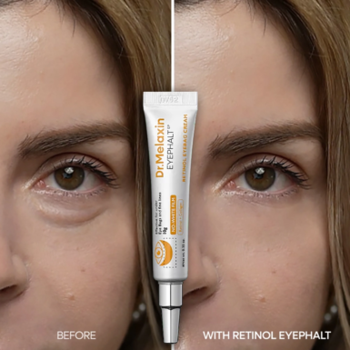 Το σωληνάριο Dr. Melaxin Retinol Eyephalt Eyebag Cream, ανάμεσα από δύο φωτογραφίες, που δείχνουν από ένα μάτι, πριν και μετά την εφαρμογή της κρέμας.