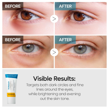 Το σωληνάριοDr. Melaxin TX Retinalsome Double Effect Eye Cream, κάτω από 4 φωτογραφίες, που δείχνουν από ένα μάτι, πριν και μετά την εφαρμογή της κρέμας.